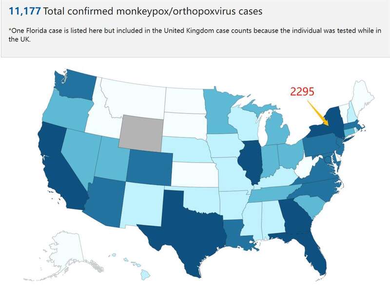 纽约已有2295例猴痘病例